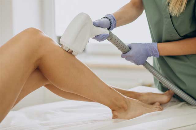 Buz Lazer Epilasyon Nedir?
