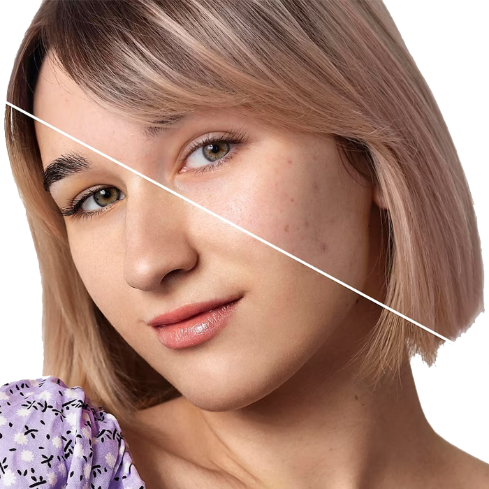 https://www.nisantasilazer.com/wp-content/uploads/2023/06/klasik-cilt-bakimlari-2.png
