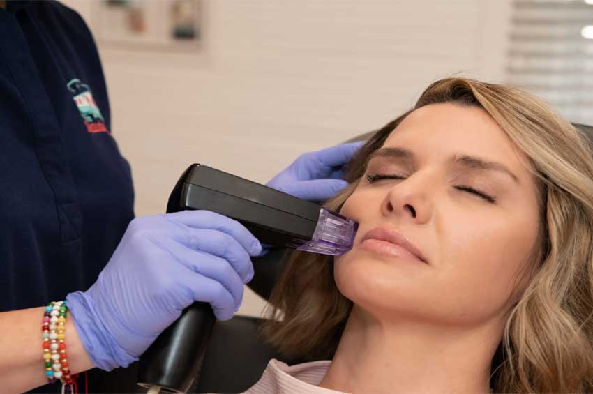 2025 Morpheus 8 Fiyatları